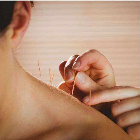 Acupuncture treatment for healing energy